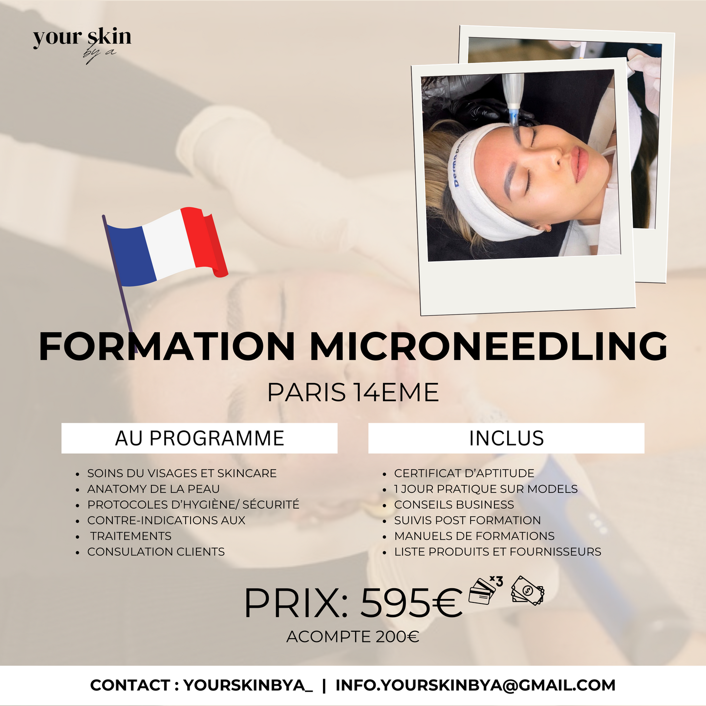 Microneedling Course - In person